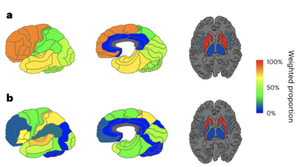 brain images