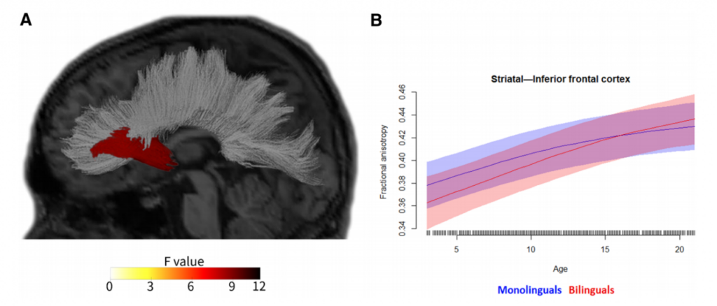 Brain image